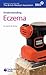 Understanding Eczema (Family Doctor)