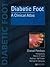 Diabetic Foot: A Clinical A...