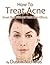 How To Treat Acne - Great Skin Without Toxic Side Effects (Health and Wellness Series Book 1)