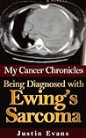 My Cancer Chronicles: Being Diagnosed with Ewing's Sarcoma My Cancer Chronicles: Being Diagnosed with Ewing's Sarcoma
