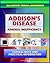 21st Century Addison's Disease Sourcebook: Clinical Data for Patients, Families, and Physicians, including Adrenal Insufficiency, Adrenocortical Hypofunction, Hypocortisolism, and Related Conditions