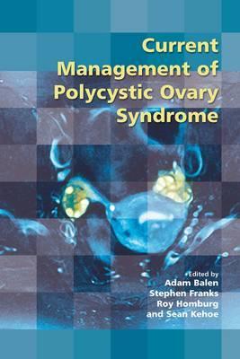 Current Management of Polycystic Ovary Syndrome