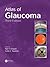 Atlas of Glaucoma
