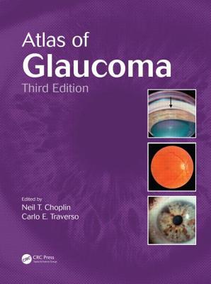 Atlas of Glaucoma (Hardcover)