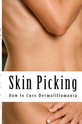 Skin Picking: How to Cure Dermatillomania