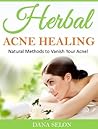 Herbal Acne Healing: Natural Methods to Vanish Your Acne!
