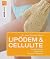 Lipödem & Cellulite: Problemzonen, Symptome, Neueste Therapien