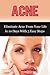 Acne: Eliminate Acne From Your Life in 10 Days With 5 Easy Steps (acne, skin care, beauty care, essential oils, cleansing diet, facial fitness, hygiene care)
