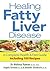Healing Fatty Liver Disease: A Complete Health & Diet Guide, Including 100 Recipes