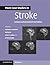 More Case Studies in Stroke: Common and Uncommon Presentations