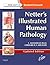 Netter's Illustrated Human Pathology Updated Edition E-Book: Netter's Illustrated Human Pathology Updated Edition E-Book