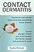 Contact Dermatitis: Traditional and Natural Treatments Plus Preventing Future Attacks