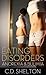 Eating Disorders: Anorexia & Bulimia
