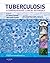 Tuberculosis E-Book: A Comprehensive Clinical Reference