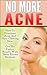 Acne; No More Acne: How To Eliminate Acne And Have Glowing Skin. Get Fast Results With These Proven Methods (Acne, Acne Free, Acne Cure, Acne Remedy, Acne Solution, Acne No More, Acne Diet)