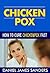Chicken Pox: How To Cure Chickenpox Fast Naturally (Health, Skin, Diseases, Personal Health, Chickenpox, Chicken Pox Remedies, Chicken Pox Treatment, Chicken Pox Treatments)