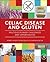 Celiac Disease and Gluten: Multidisciplinary Challenges and Opportunities