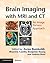 Brain Imaging with MRI and CT by Zoran Rumboldt