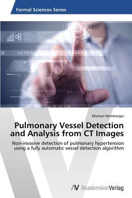 Pulmonary Vessel Detection and Analysis from CT Images: Non-invasive detection of pulmonary hypertension using a fully automatic vessel detection algorithm