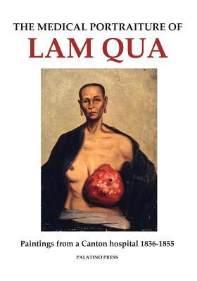 The Medical Portraiture of Lam Qua: Paintings from a Canton hospital 1836-1855 (Paperback)