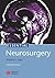 Essential Neurosurgery