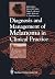 Diagnosis and Management of Melanoma in Clinical Practice