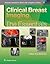 Clinical Breast Imaging: The Essentials (Essentials Series)