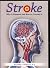 Stroke DVD: Why It Happens ...