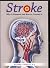 Stroke DVD by Richard C. Senelick