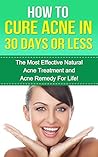 Acne: The Most Effective Natural Acne Treatment and Acne Remedy for Life (Acne, Acne Cure, Cure Acne, Acne Remedy, Acne Treatment, Acne, How To Cure Acne, Acne Removal, Skin Care)