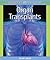 Organ Transplants