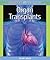 Organ Transplants by Henry Wouk