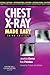 Chest X-Ray Made Easy by Jonathan Corne Chest X-Ray Made Easy by Jonathan Corne