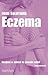 Eczema  by Patsy Westcott