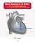 Basic Concepts of EKG: A Simplified Approach