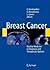 Breast Cancer: Nuclear Medi...