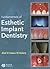 Fundamentals of Esthetic Implant Dentistry