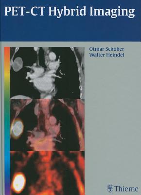 Pet-CT Hybrid Imaging