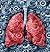 Understanding Mesothelioma