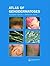 Atlas of Genodermatoses by Gianluca Tadini