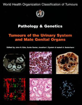 Pathology and Genetics of Tumours of the Urinary System and Male Genital Organs. Who Classification of Tumours, Volume 7