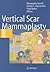 Vertical Scar Mammaplasty