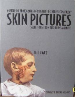 The Face (Skin Pictures Selections from the Burns Archive)