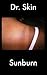 Sunburn