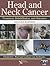 Head and Neck Cancer: Treatment, Rehabilitation, and Outcomes (DVD included)