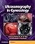 Ultrasonography in Gynecology by Botros R.M.B Rizk