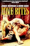 Love Bites