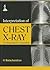Interpretation of Chest X-R...