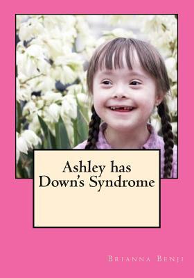 Ashley has Down's Syndrome (Special Girls)