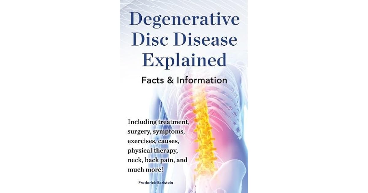 Degenerative Disc Disease Explained Including treatment, surgery